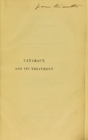 view Cataract, and its treatment, comprising an easy mode of dividing the cornea for its extraction, and appropriate means for removing the different forms of that affection / by John Scott.