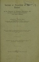 view Section or exsection of the rectus : in the treatment of paralytic strabismus, and that due to extreme over-correction with loss of motion / by Arthur E. Prince.