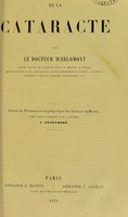 view De la cataracte / par le Docteur Warlomont.