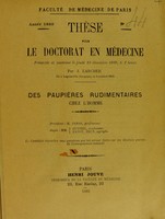view Des paupières rudimentaires chez l'homme : thése pour le doctorat en médecine / par J. Larcher.