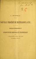 view Nouveau procédé de blépharoplastie : traitement de la conjunctivite croupeuse et dyphthérique par l'application d'une solution de chloral hydraté / F. Businelli.