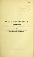 view De la tonsure conjonctivale et de son efficacité contre les lésions panniformes et chroniques de la cornée et contre les ulcérations vascularisées et les opacités interlammelaires de cette mémbrane / par S. Funari.