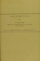 view Carcinoma oculi / door W. M. de Vries.