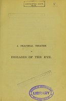 view A practical treatise of diseases of the eye / Édouard Meyer and Freeland Fergus.