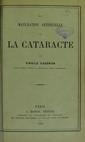 view La maturation artificielle de la cataracte / par Virgile Caudron.