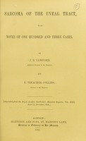 view Sarcoma of the uveal tract : with notes of one hundred and three cases / by J. B. Lawford and E. Treacher Collins.