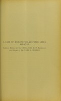 view A case of microphthalmus with upper-lid cyst : clinical report / by Charles H. May ; pathological report by Ward A. Holden.