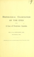 view Histological examination of the eyes from a case of pernicious anaemia / by G. E. de Schweinitz.