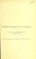 view Primary carcinoma of the caruncle / by G. E. de Schweinitz.