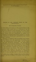 view Diseases of the lymphoid tissue of the conjunctiva / by E. Treacher Collins.