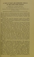 view A case of waxy and syphilitic disease of the liver with ascites : portion of a clinical lecture / by T. Grainger Stewart.