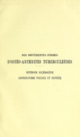 view Des différentes formes d’ostéo-arthrites tuberculeuses, de leur traitement par la méthode sclérogène pure ou combinée à l’arthrectomie précoce et répétée (curettages et résections atypiques) surtout chez l’enfant. (Méthode du professeur Lannelongue) / par P. Mauclaire.