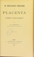 view Du decollement premature du placenta insere normalement / par Louis Dumarcet.