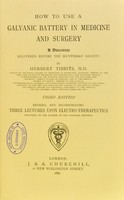 view How to use a galvanic battery in medicine and surgery : a discourse delivered before the Hunterian Society / by Herbert Tibbits.