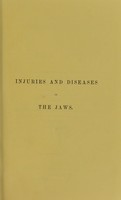 view Injuries and diseases of the jaws : the Jacksonian prize essay of the Royal College of Surgeons of England, 1867 / by Christopher Heath.