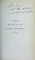 view An inquiry into the nature and causes of lateral deformity of the spine : in reference, more especially, to the pernicious effects of certain moral and physical influences, resulting from the modern system of female education : with practical hints for the prevention and cure of this affection / by Edward W. Duffin.