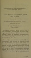 view Large pendulous tumor from the cheek, of many years growth, in a gentleman advanced in years, removed by operation / by E. L. Hussey.