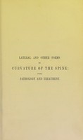 view Lectures on the pathology and treatment of lateral and other forms of curvature of the spine / by William Adams.