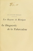 view Les rayons de Röntgen et le diagnostic de la tuberculose / par A. Beclere.