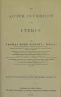 view On acute inversion of the uterus / by Thomas More Madden.