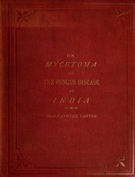 view On mycetoma, or, The fungus disease of India / by H. Vandyke Carter.