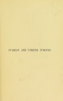 view On ovarian and uterine tumours : their diagnosis and treatment / by T. Spencer Wells.