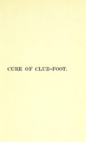 view On the cure of club-foot without cutting tendons : and on certain new methods of treating other deformities / by Richard Barwell.