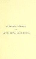 view Operative surgery in the Calcutta Medical College Hospital : statistics, cases and comments / by Kenneth McLeod.