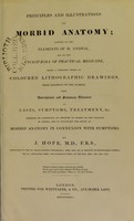 view Principles and illustrations of morbid anatomy : adapted to the elements of M. Andral, and to the Cyclopaedia of practical medicine, being a complete series of coloured lithographic drawings from originals by the author; with descriptions and summary allusions to cases, symptoms, treatment, &c. ... / by J. Hope.