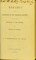 view Remarks on the operation of the perineal section : for the cure of stricture of the urethra and fistula in perineo / by F.G. William Mullar.