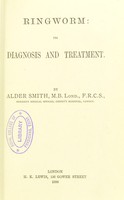 view Ringworm : its diagnosis and treatment / by Alder Smith.