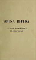 view Spina bifida : anatomie pathologique et embryogénie / Dr. M. Denuce.