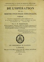 view De l'opération de la hernie inguinale étranglée; thèse. Concours pour la chaire de médecine opératoire / [Jean Nicolas Marjolin].