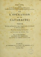 view De l'opération de la cataracte; thèse seutenne publiquement, dans l'amphithèâtre de la faculté de médecine de Paris, en présence des juges du concours; le vendredi 24 Janvier 1812 / par A.E. Tartra.