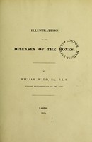 view Illustrations of the diseases of the bones / by William Wadd.