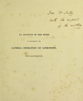view An account of the mode of performing the lateral operation of lithotomy / [Edward Stanley].