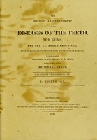 view The history and treatment of the diseases of the teeth, the gums, and the alveolar processes, with the operations which they respectively require. To which are added, observations on other diseases of the mouth, and on the mode of fixing artificial teeth / By Joseph Fox.