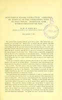 view Dupuytren's finger contraction : operation by removal of the contracting band by open wound, immediate cure without reaction or pain / by W.W. Keen.