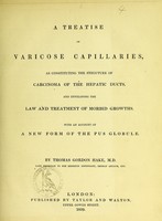 view A treatise on varicose capillaries : as constituting the structure of carcinoma of the hepatic ducts, and developing the law and treatment of morbid growths, with an account of a new form of the pus globule / by Thomas Gordon Hake.