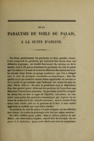 view De la paralysie du voile du palais, à la suite d'angine : thèse pour le doctorat en médecine, présentée et soutenue le 11 août 1854 / par V.-P.-Alfred Maingault.