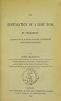 view The restoration of a lost nose by operation : exemplified in a series of cases / by John Hamilton.