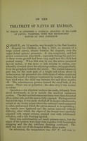 view On the treatment of naevus by excision : with a clinical analysis of five hundred and sixty-four cases of naevus / by Robert William Parker.