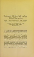view On asymmetry of the lower limbs as a cause of lateral spinal curvature : with a description of a new method for readily and accurately determining any variation in the lengths of the lower extremities / by Thomas G. Morton.
