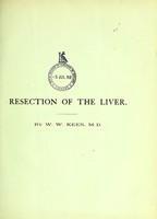 view On resection of the liver, especially for hepatic tumors : with the report of a successful case of resection for an adenoma of the bile-ducts, and a table of twenty recorded cases of hepatic operations / by W.W. Keen.