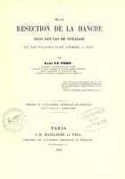 view De la résection de la hanche dans les cas de coxalgie et de plaies par armes à feu / par Léon le Fort.