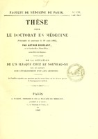 view De la situation de l'S iliaque chez le nouveau-né dans ses rapports avec l'établissement d'un anus artificiel : thèse pour le doctorat en médecine présentée et soutenue le 18 août 1863 / par Arthur Bourcart.