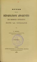 view Étude sur les déformations apparentes des membres inférieures dans la coxalgie / par P. Benoit.