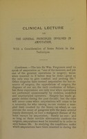 view Clinical lecture on the general principles involved in amputation : with a consideration of some points in the technique / by Frederic S. Dennis ; reported by Seymour H. Houghton.