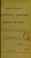 view On the painless extirpation of cancerous growths by congelation and caustic : including a report of the recent use of prolonged congelation in the cancer wards of the Middlesex Hospital / by James Arnott.