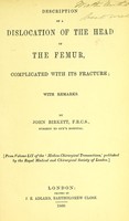 view Description of a dislocation of the head of the femur, complicated with its fracture : with remarks / by John Birkett.